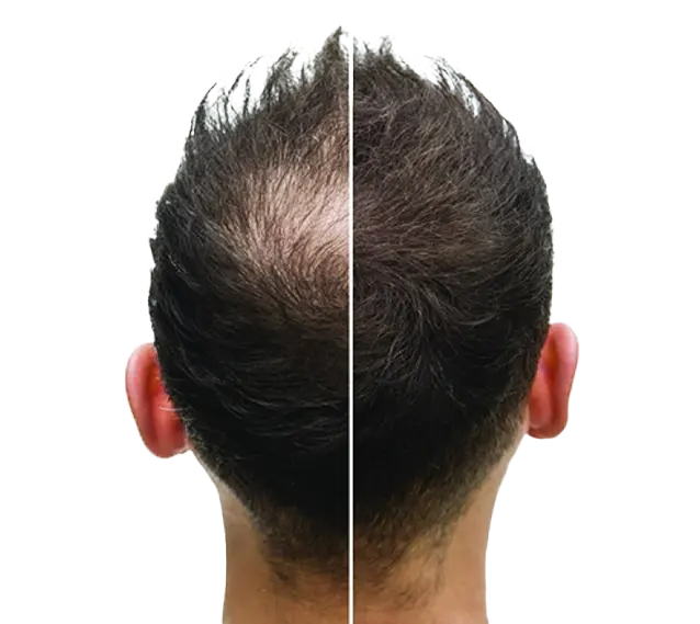 Benefit Image