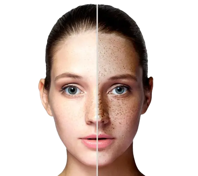 Benefit Image