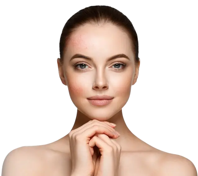 Benefit Image