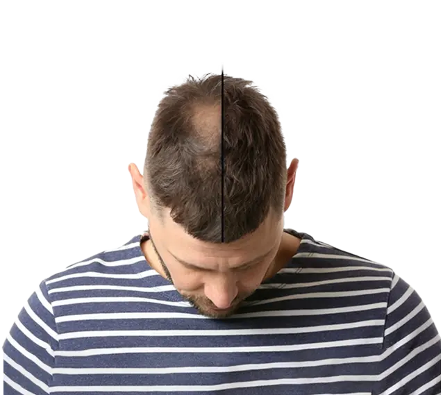 Benefit Image