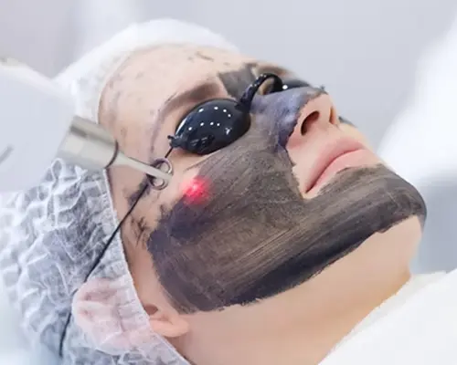 black-peels-treatment