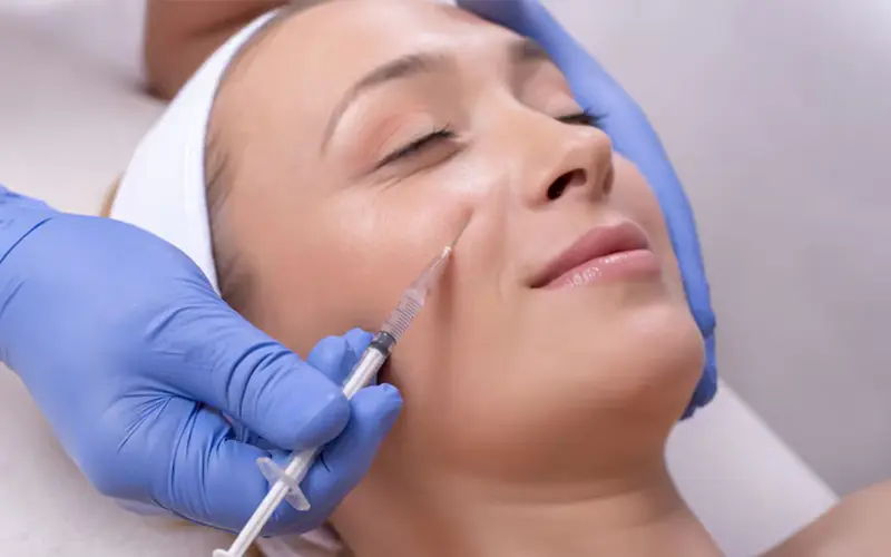 Dermal Filler