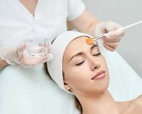 glycolic-peels-treatment