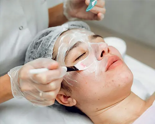 lactic-peels-treatment