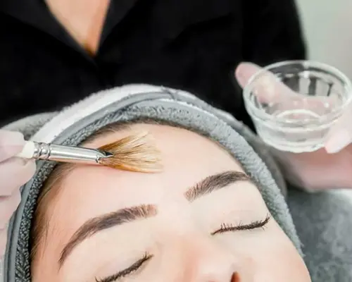 nomelan-peels-treatment