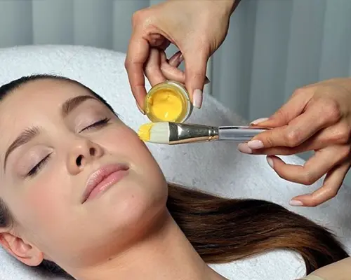 yellow-peel-treatment